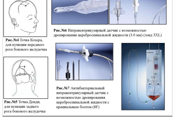 Кракен ссылка работает